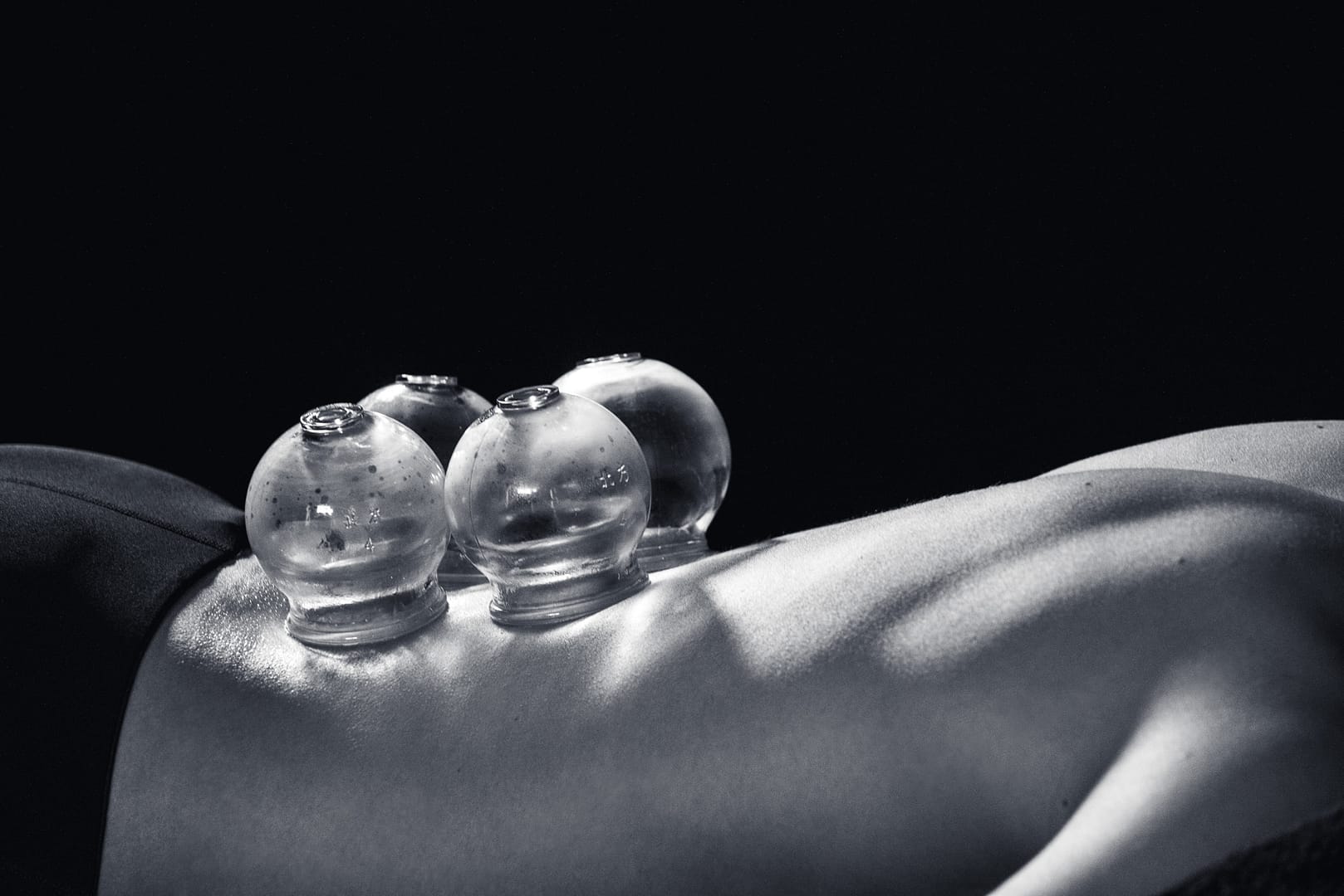 Fire Cupping Fire Cupping