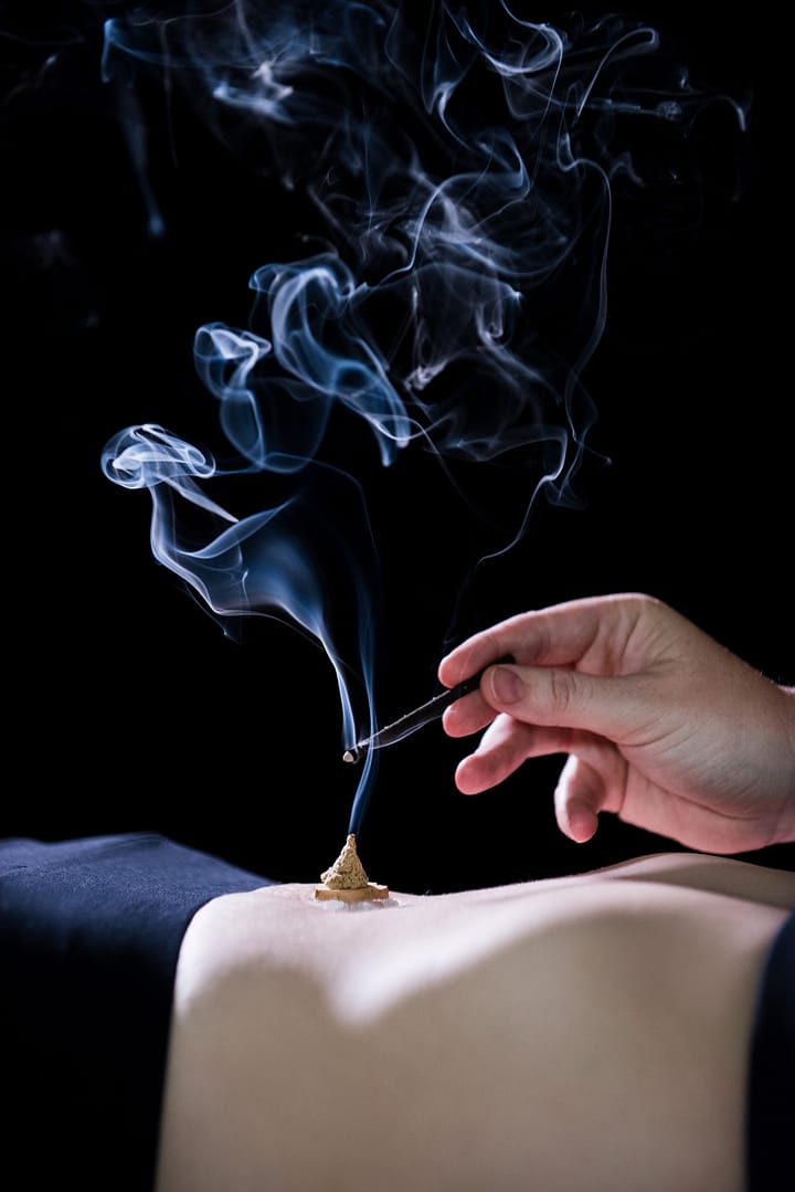 Moxibustion Moxibustion